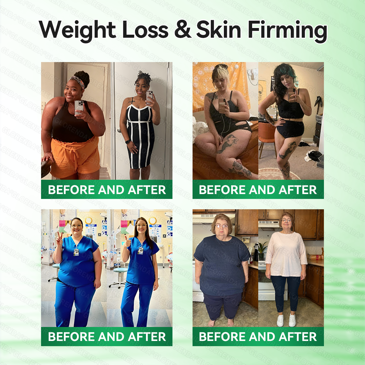 𝐆𝐋𝐎𝑹𝑬𝑵𝑫𝗔®𝑴𝒐𝒓𝒊𝒏𝒈𝗮 · 𝗕𝗲𝗿𝗯𝗲𝗿𝙞𝙣𝙚 × 𝙉𝘼𝐃+ 𝟏𝟎-𝐢𝐧-𝟏 𝗔𝗱𝘃𝗮𝗻𝗰𝙚𝙙 𝙉𝙖𝙣𝙤 𝙈𝙞𝙘𝙧𝙤𝙣𝙚𝙚𝐝𝐥𝐞 𝐏𝐚𝐭𝙘𝙝(𝐉𝐮𝐬𝐭 𝐨𝐧𝐜𝐞 𝐚 𝐝𝐚𝐲, 𝐯𝐢𝐬𝐢𝐛𝐥𝐞 𝐜𝐡𝐚𝐧𝐠𝐞𝐬 𝐢𝐧 𝟕 𝐝𝐚𝐲𝐬）🥨𝐅𝐨𝐫 𝐨𝐛𝐞𝐬𝐢𝐭𝐲, 🅛🅞🅞🅢🅔 🅢🅚🅘🅝,𝐝𝐢𝐚𝐛𝐞𝐭𝐞𝐬, 𝐬𝐥𝐞𝐞𝐩 𝐚𝐩𝐧𝐞𝐚, 𝐣𝐨𝐢𝐧𝐭 𝐢𝐬𝐬𝐮𝐞𝐬, 𝐚𝐧𝐝 𝐦𝐨𝐫𝐞🥨