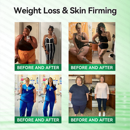 𝐆𝐋𝐎𝑹𝑬𝑵𝑫𝗔®𝑴𝒐𝒓𝒊𝒏𝒈𝗮 · 𝗕𝗲𝗿𝗯𝗲𝗿𝙞𝙣𝙚 × 𝙉𝘼𝐃+ 𝟏𝟎-𝐢𝐧-𝟏 𝗔𝗱𝘃𝗮𝗻𝗰𝙚𝙙 𝙉𝙖𝙣𝙤 𝙈𝙞𝙘𝙧𝙤𝙣𝙚𝙚𝐝𝐥𝐞 𝐏𝐚𝐭𝙘𝙝(𝐉𝐮𝐬𝐭 𝐨𝐧𝐜𝐞 𝐚 𝐝𝐚𝐲, 𝐯𝐢𝐬𝐢𝐛𝐥𝐞 𝐜𝐡𝐚𝐧𝐠𝐞𝐬 𝐢𝐧 𝟕 𝐝𝐚𝐲𝐬）🥨𝐅𝐨𝐫 𝐨𝐛𝐞𝐬𝐢𝐭𝐲, 🅛🅞🅞🅢🅔 🅢🅚🅘🅝,𝐝𝐢𝐚𝐛𝐞𝐭𝐞𝐬, 𝐬𝐥𝐞𝐞𝐩 𝐚𝐩𝐧𝐞𝐚, 𝐣𝐨𝐢𝐧𝐭 𝐢𝐬𝐬𝐮𝐞𝐬, 𝐚𝐧𝐝 𝐦𝐨𝐫𝐞🥨