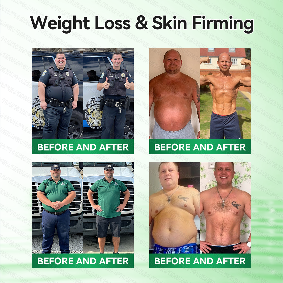 𝐆𝐋𝐎𝑹𝑬𝑵𝑫𝗔®𝑴𝒐𝒓𝒊𝒏𝒈𝗮 · 𝗕𝗲𝗿𝗯𝗲𝗿𝙞𝙣𝙚 × 𝙉𝘼𝐃+ 𝟏𝟎-𝐢𝐧-𝟏 𝗔𝗱𝘃𝗮𝗻𝗰𝙚𝙙 𝙉𝙖𝙣𝙤 𝙈𝙞𝙘𝙧𝙤𝙣𝙚𝙚𝐝𝐥𝐞 𝐏𝐚𝐭𝙘𝙝(𝐉𝐮𝐬𝐭 𝐨𝐧𝐜𝐞 𝐚 𝐝𝐚𝐲, 𝐯𝐢𝐬𝐢𝐛𝐥𝐞 𝐜𝐡𝐚𝐧𝐠𝐞𝐬 𝐢𝐧 𝟕 𝐝𝐚𝐲𝐬）🥨𝐅𝐨𝐫 𝐨𝐛𝐞𝐬𝐢𝐭𝐲, 🅛🅞🅞🅢🅔 🅢🅚🅘🅝,𝐝𝐢𝐚𝐛𝐞𝐭𝐞𝐬, 𝐬𝐥𝐞𝐞𝐩 𝐚𝐩𝐧𝐞𝐚, 𝐣𝐨𝐢𝐧𝐭 𝐢𝐬𝐬𝐮𝐞𝐬, 𝐚𝐧𝐝 𝐦𝐨𝐫𝐞🥨