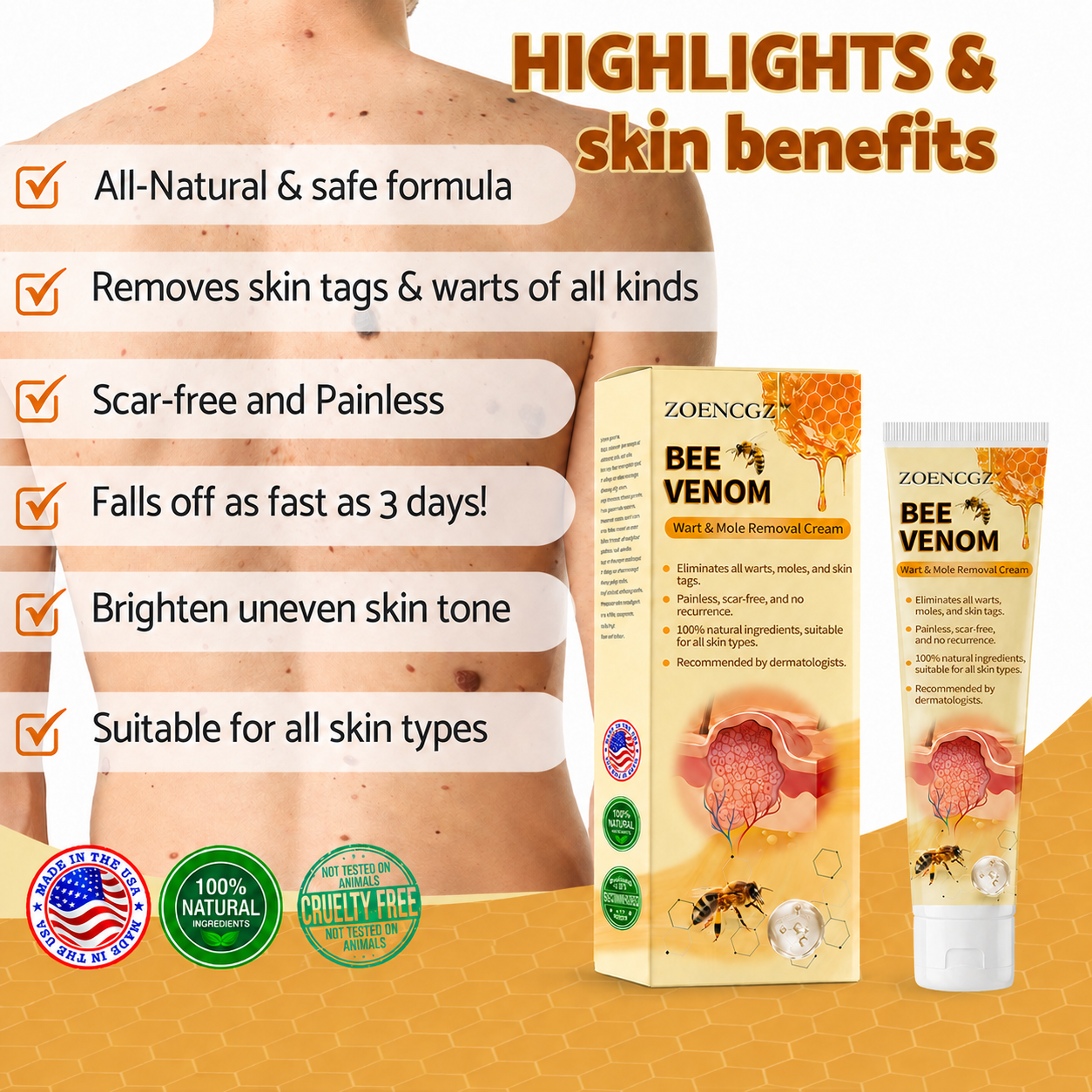 🐝🐝 𝐙𝐨𝐞𝐧𝐜𝐠𝐳™ 𝐁𝐞𝐞 𝐕𝐞𝐧𝐨𝐦 𝐌𝐨𝐥𝐞 𝐚𝐧𝐝 𝐖𝐚𝐫𝐭 𝐓𝐫𝐞𝐚𝐭𝐦𝐞𝐧𝐭 𝐂𝐫𝐞𝐚𝐦