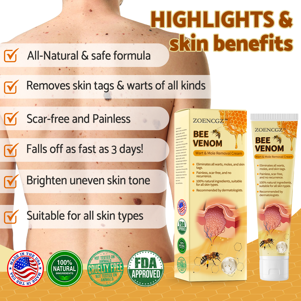 𝐙𝐨𝐞𝐧𝐜𝐠𝐳™ 𝐁𝐞𝐞 𝐕𝐞𝐧𝐨𝐦 𝐌𝐨𝐥𝐞 𝐚𝐧𝐝 𝐖𝐚𝐫𝐭 𝐓𝐫𝐞𝐚𝐭𝐦𝐞𝐧𝐭 𝐂𝐫𝐞𝐚𝐦