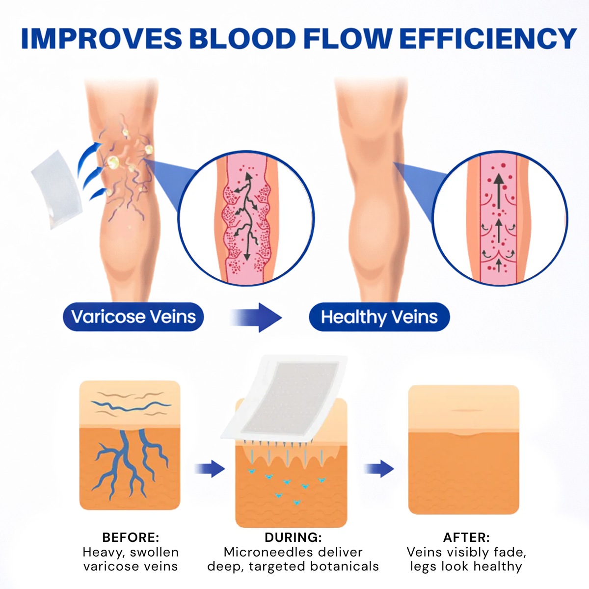 𝐆𝑳𝑶𝗥𝙀𝙉𝐃𝑨® 𝑽𝗲𝗶𝙣 𝘾𝐨𝐧𝘁𝗼𝙪𝙧 𝙈𝙞𝐜𝐫𝒐𝒏𝒆𝗲𝗱𝗹𝙚 𝙋𝙖𝐭𝐜𝒉 𝒘𝒊𝘁𝗵 𝗔𝙙𝙫𝙖𝙣𝙘𝐞𝐝 𝐃𝒊𝒐𝒔𝗺𝙞𝐧 & 𝑯𝒆𝘀𝗽𝗲𝙧𝙞𝙙𝙞𝐧 𝐃𝒆𝒍𝒊𝒗𝗲𝗿𝙮🌿𝟕-𝐃𝐚𝐲 𝐕𝐢𝐬𝐢𝐛𝐥𝐞 𝐑𝐞𝐬𝐮𝐥𝐭𝐬 𝐟𝐨𝐫 𝐕𝐚𝐫𝐢𝐜𝐨𝐬𝐞 𝐕𝐞𝐢𝐧𝐬 — 𝗔𝗱𝘃𝗮𝗻𝗰𝗲𝗱 𝗛𝗲𝗿𝗯𝗮𝗹 𝗕𝗹𝗲𝗻𝗱 𝗧𝗮𝗿𝗴𝗲𝘁𝘀 𝗦𝗽𝗶𝗱𝗲𝗿 𝗩𝗲𝗶𝗻𝘀 & 𝗥𝗲𝗹𝗶𝗲𝘃𝗲𝘀 𝗛𝗲𝗮𝘃𝘆, 𝗧𝗶𝗿𝗲𝗱 𝗟𝗲𝗴𝘀